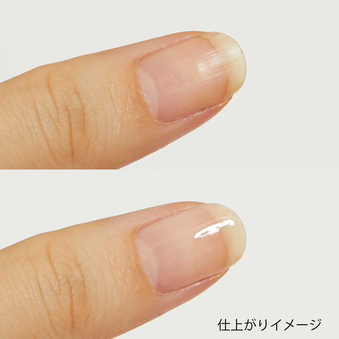 nailmatic(ネイルマティック)『NM B ブライトニングケア』の使用感をレポに関する画像7