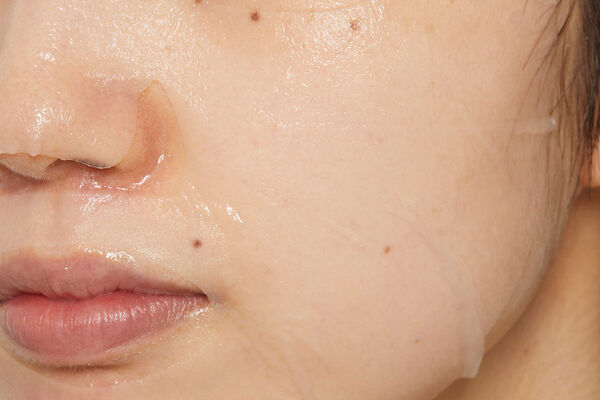 メンズもパックをする時代! 毛穴やニキビなど、気になる肌悩みを一気に解決♡の画像