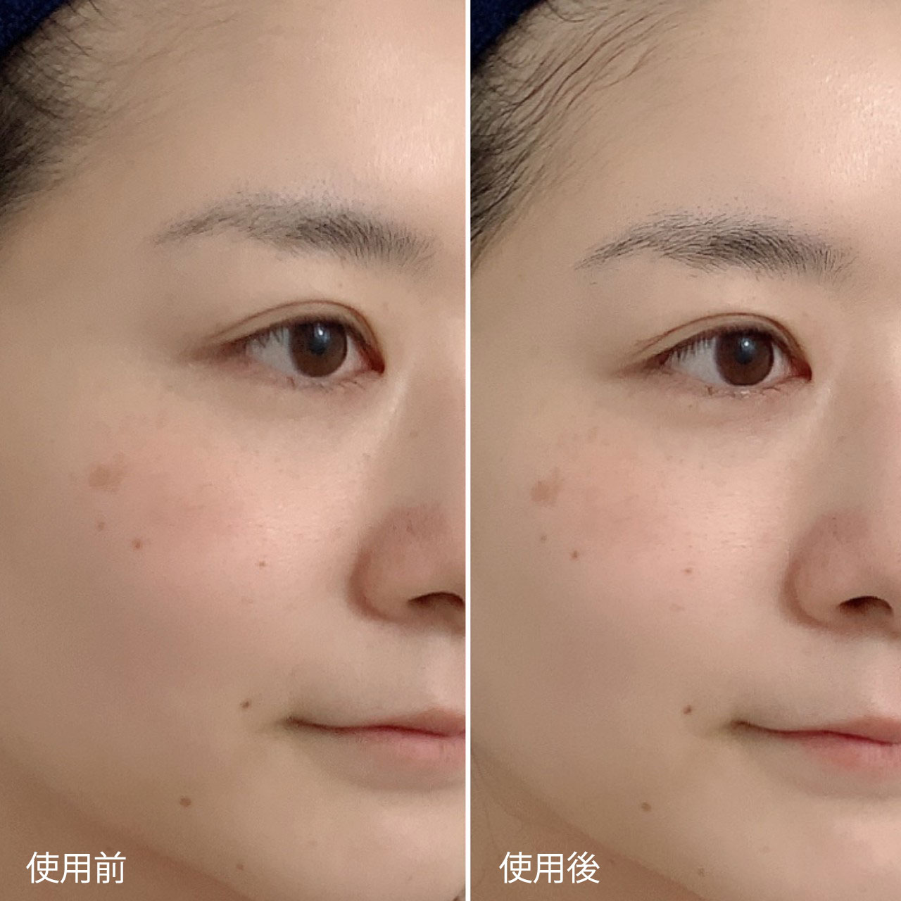 酵素洗顔の効果って!? おすすめの酵素洗顔14選も紹介【口コミ付】の画像